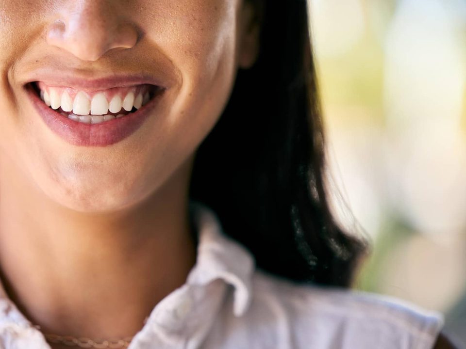 Sonrisa amplia y natural